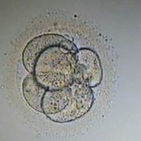 อยากมีลูก...ใครว่าง่าย!! (ICSI & IVF)